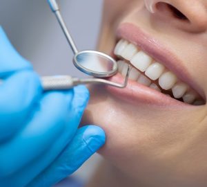 Answering Your Most Pressing Questions About Seeing a Dental Hygienist in Weston Creek, Canberra