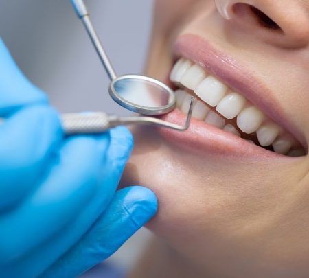 Answering Your Most Pressing Questions About Seeing a Dental Hygienist in Weston Creek, Canberra